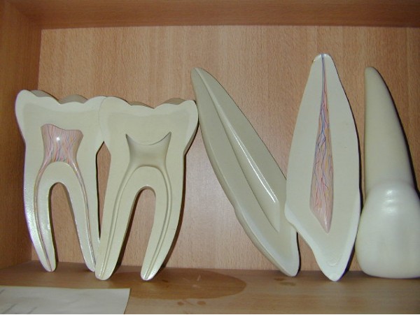 דגם אנטומי של מבנה השן 